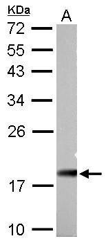 Anti-NDUFAB1 antibody used in Western blot. GTX111875