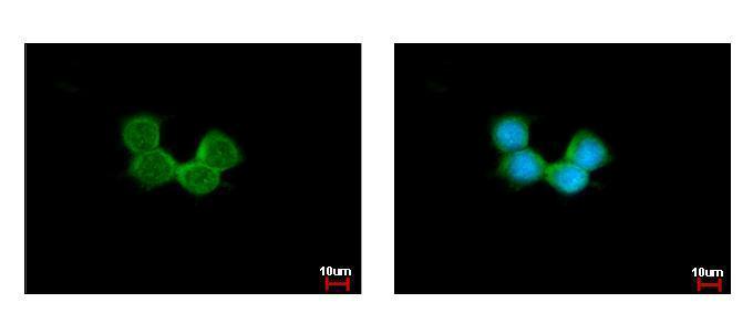 Anti-NDUFAB1 antibody used in ICC/IF. GTX114573