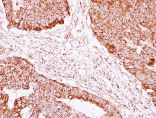 Anti-NDUFAB1 antibody used in IHC (Formalin-fixed paraffin-embedded sections). GTX114573