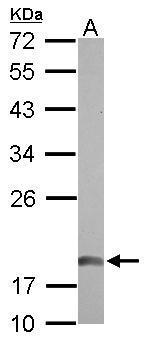 Anti-NDUFAB1 antibody used in Western blot. GTX114573