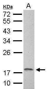 Anti-NDUFAB1 antibody used in Western blot. GTX114573