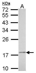 Anti-NDUFAB1 antibody used in Western blot. GTX114573