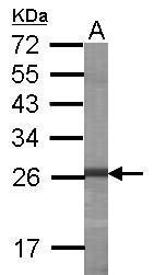 Anti-HUWE1 antibody [C2C3], C-term used in WB-Ag. GTX109706