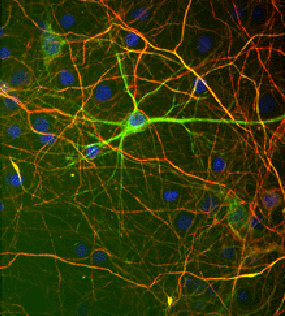 Anti-Neurofilament NF-H antibody used in ICC/IF. GTX82646
