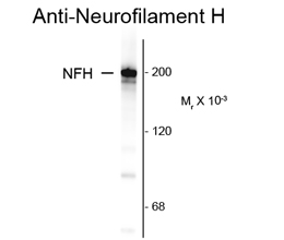 Anti-Neurofilament NF-H antibody [NAP4] used in Western blot. GTX82647