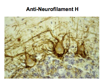 Anti-Neurofilament NF-H antibody [NAP4] used in ICC/IF. GTX82647