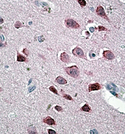 Anti-Neurogranin antibody, Internal used in IHC (Formalin-fixed paraffin-embedded sections). GTX88301