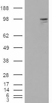 Anti-Neuroligin 3 antibody, Internal used in Western blot. GTX88872