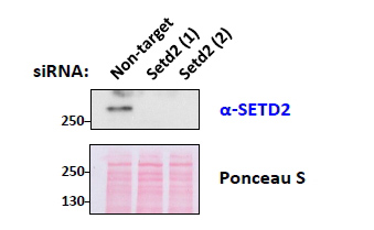 Anti-HYPB / SETD2 antibody, Internal used in Western blot. GTX88922