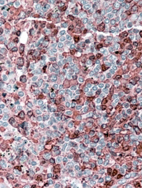 Anti-NFATC2 / NFAT1 antibody, Internal used in IHC (Formalin-fixed paraffin-embedded sections). GTX88316