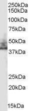 Anti-NHERF2 (isoform a) antibody, Internal used in Western blot. GTX89452