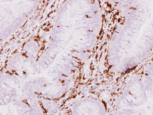 Anti-Iba1 antibody used in IHC (Formalin-fixed paraffin-embedded sections). GTX100042