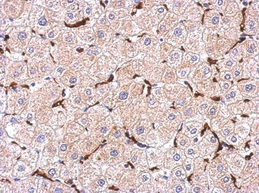 Anti-Iba1 antibody used in IHC (Formalin-fixed paraffin-embedded sections). GTX100042