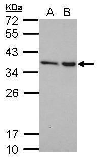 Anti-NIP30 antibody used in Western blot. GTX122479