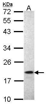 Anti-Iba1 antibody used in Western blot. GTX100042