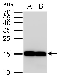 Anti-Iba1 antibody used in Western blot. GTX100042