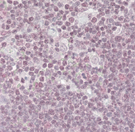 Anti-NIPP1 / PPP1R8 antibody, C-term used in IHC (Formalin-fixed paraffin-embedded sections). GTX25300