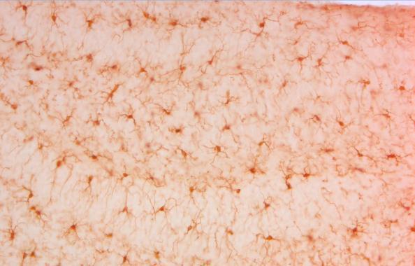 Anti-Iba1 antibody used in IHC (Formalin-fixed paraffin-embedded sections). GTX100042