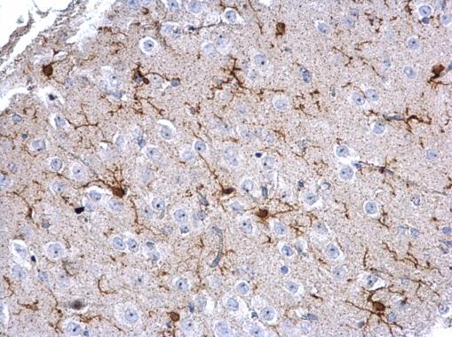 Anti-Iba1 antibody used in IHC (Formalin-fixed paraffin-embedded sections). GTX100042
