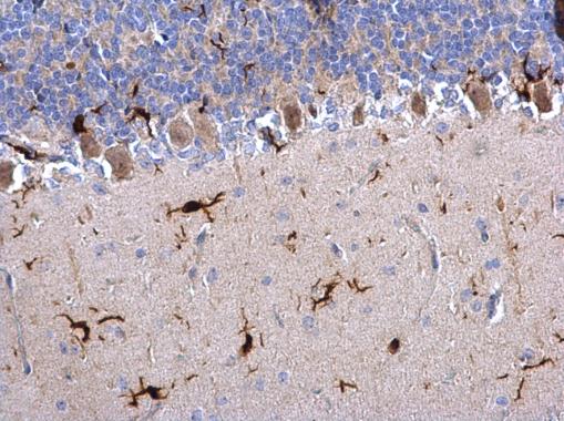 Anti-Iba1 antibody used in IHC (Formalin-fixed paraffin-embedded sections). GTX100042