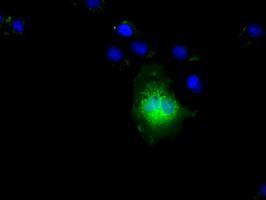 Anti-NIT2 antibody [2B9] used in ICC/IF. GTX84036