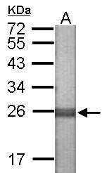 Anti-NLRP7 antibody used in WB-Ag. GTX121267