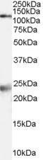 Anti-NMDA receptor 1 / GRIN1 antibody, Internal used in Western blot. GTX89302