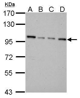 Anti-NNT antibody used in Western blot. GTX103015