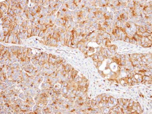 Anti-NNT antibody used in IHC (Formalin-fixed paraffin-embedded sections). GTX103015