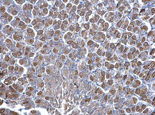Anti-NNT antibody used in IHC (Formalin-fixed paraffin-embedded sections). GTX103015