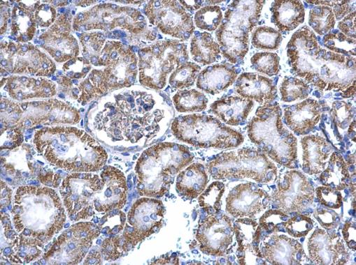 Anti-NNT antibody used in IHC (Formalin-fixed paraffin-embedded sections). GTX103015