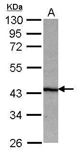 Anti-NO66 antibody [C2C3], C-term used in Western blot. GTX119355