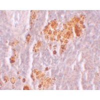 Anti-NOD5 antibody used in Immunohistochemistry. GTX84999