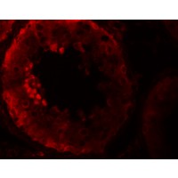 Anti-NOD6 antibody used in ICC/IF. GTX85159