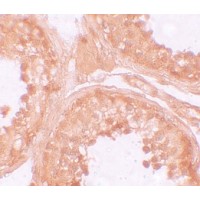 Anti-NOD6 antibody used in Immunohistochemistry. GTX85159
