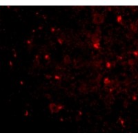 Anti-NogoA antibody used in ICC/IF. GTX85447