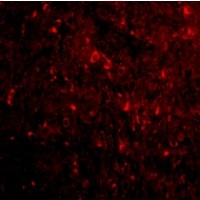 Anti-NogoA antibody used in ICC/IF. GTX85448