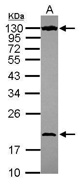 Anti-NOL6 antibody [C2C3], C-term used in Western blot. GTX116786