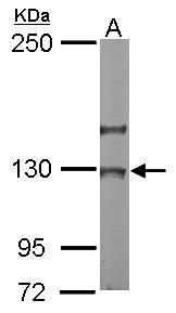 Anti-NOL6 antibody [C2C3], C-term used in Western blot. GTX116786