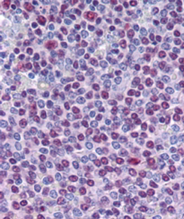 Anti-NONO / p54NRB antibody, C-term used in IHC (Formalin-fixed paraffin-embedded sections). GTX89315