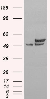 Anti-NONO / p54NRB antibody, C-term used in Western blot. GTX89315