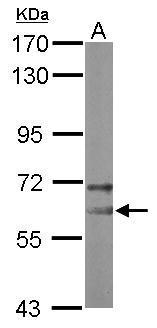 Anti-NOP58 antibody [N1N3] used in Western blot. GTX116419