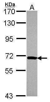 Anti-NOP58 antibody [N1N3] used in Western blot. GTX116419