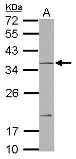 Anti-NOTCH2NL antibody [N2C3] used in Western blot. GTX117659