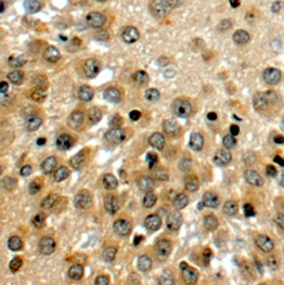 Anti-NOTCH3 antibody, C-term used in IHC (Formalin-fixed paraffin-embedded sections). GTX89476
