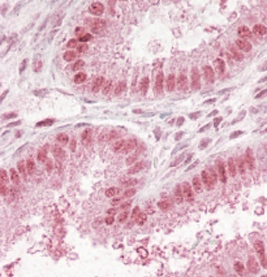 Anti-Npap60 / Nup50 antibody, C-term used in IHC (Formalin-fixed paraffin-embedded sections). GTX89862