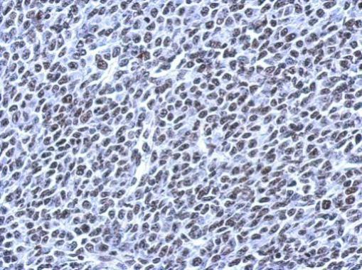 Anti-NPD014 antibody used in IHC (Formalin-fixed paraffin-embedded sections). GTX120166