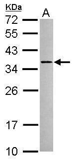 Anti-NPD014 antibody used in Western blot. GTX120166