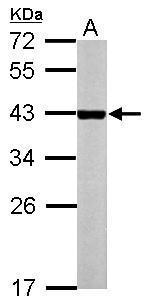 Anti-NR1I3 antibody used in Western blot. GTX113909