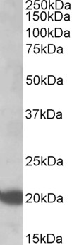 Anti-N-Ras antibody, Internal used in Western blot. GTX88676